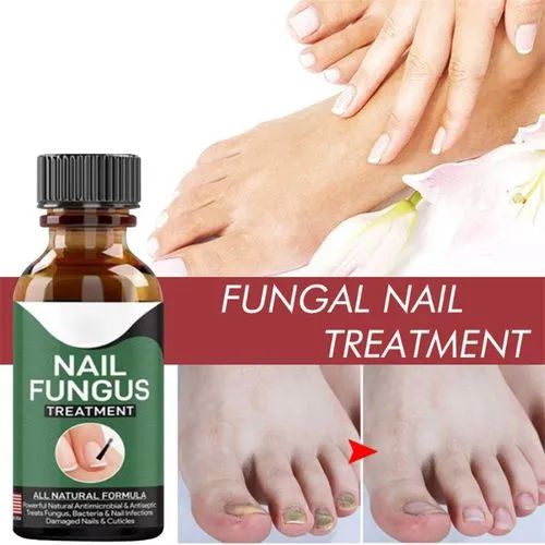 Nail  Clean Serum Care Treatments Foot Nail Fungus Removal Gel
