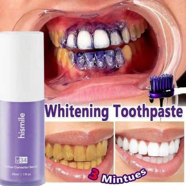 Hismile Whitening Toothpaste with Colour Corrector Serum for the best toothpaste for bright smile